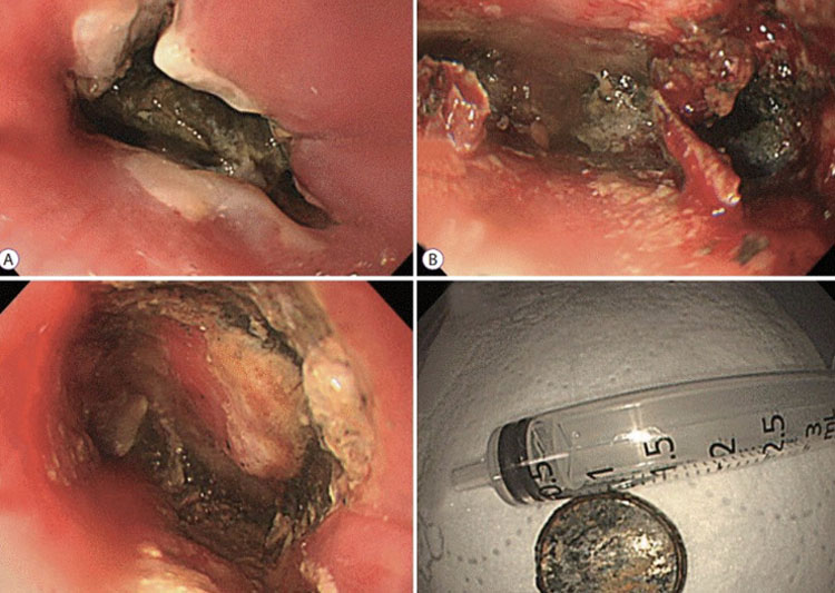 ������ ������ ������