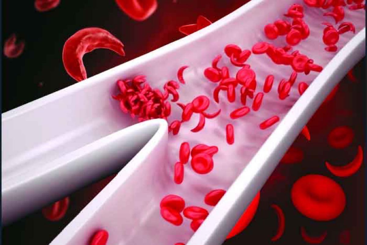 �������� ��������